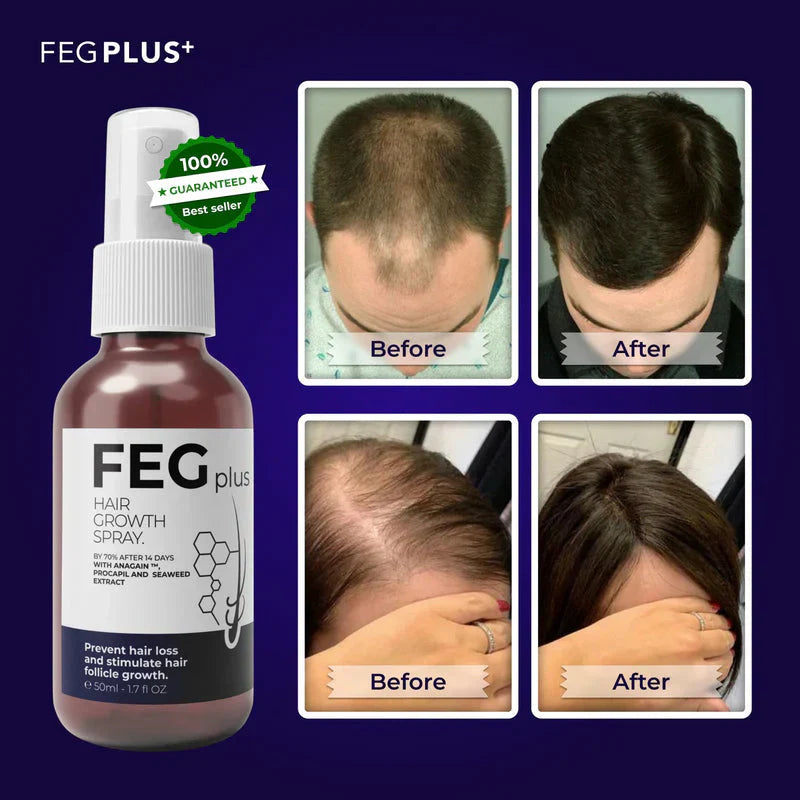 FEG Plus
FEG Plus Hair Growth Spray